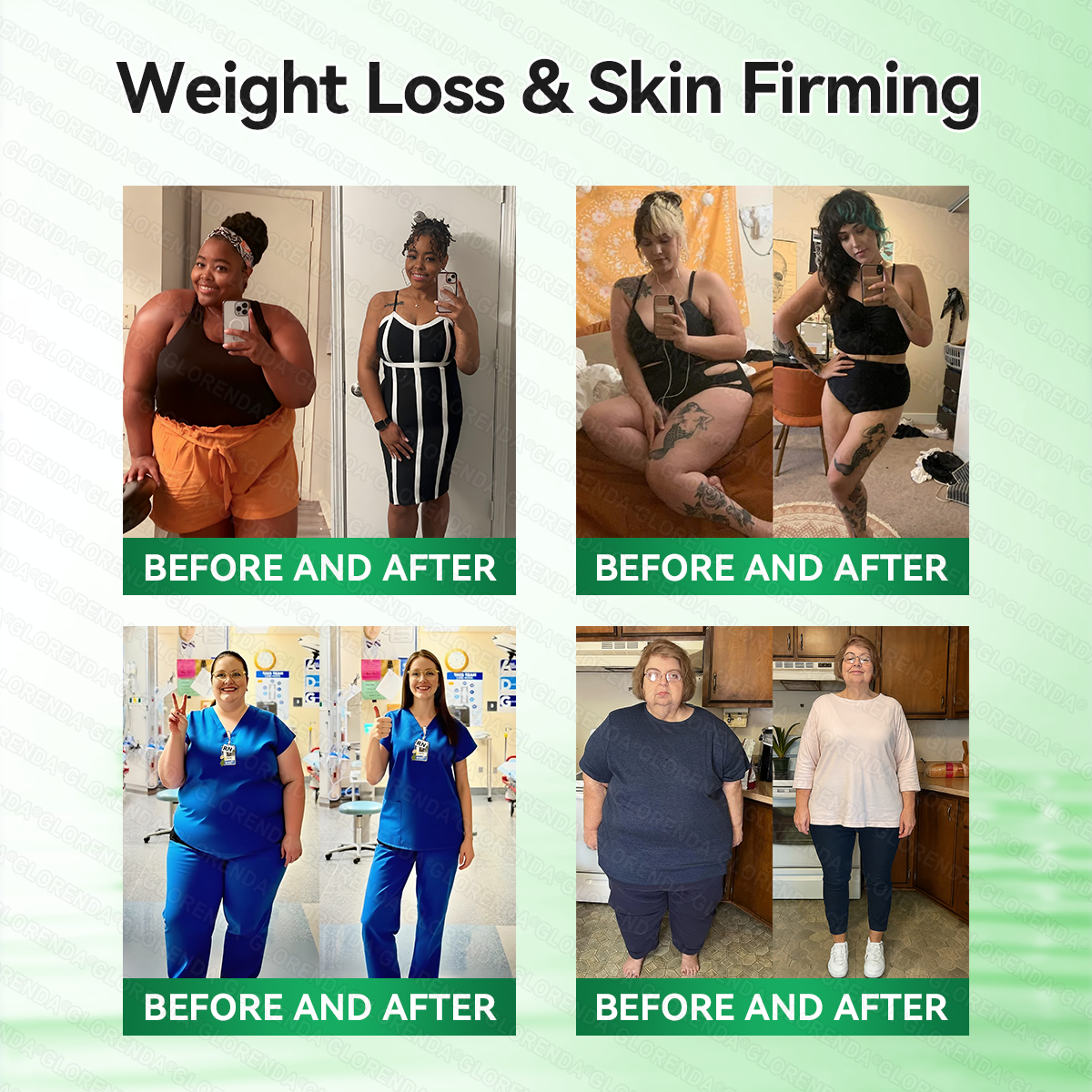 🇬🇧𝑶𝒇𝒇𝒊𝒄𝒊𝒂𝒍 𝑺𝒕𝒐𝒓𝒆  | 🌻𝐆𝑳𝑶𝗥𝗘𝗡𝘿𝘼® 𝙈𝒐𝒓𝒊𝒏𝒈𝗮 · 𝗕𝗲𝗿𝗯𝐞𝐫𝐢𝐧𝙚 × 𝙉𝑨𝑫+ 𝟏𝟎-𝙞𝙣-1 𝘼𝒅𝒗𝒂𝒏𝒄𝒆𝐝 𝐍𝐚𝐧𝙤 𝙈𝙞𝙘𝙧𝙤𝙣𝒆𝒆𝒅𝒍𝐞 𝐏𝐚𝐭𝙘𝙝(𝐉𝐮𝐬𝐭 𝐨𝐧𝐜𝐞 𝐚 𝐝𝐚𝐲, 𝐯𝐢𝐬𝐢𝐛𝐥𝐞 𝐜𝐡𝐚𝐧𝐠𝐞𝐬 𝐢𝐧 𝟕 𝐝𝐚𝐲𝐬） ✅ 𝐅𝐨𝐫 𝐨𝐛𝐞𝐬𝐢𝐭𝐲, 🅛🅞🅞🅢🅔 🅢🅚🅘🅝,𝐝𝐢𝐚𝐛𝐞𝐭𝐞𝐬, 𝐬𝐥𝐞𝐞𝐩 𝐚𝐩𝐧𝐞𝐚, 𝐣𝐨𝐢𝐧𝐭 𝐢𝐬𝐬𝐮𝐞𝐬, 𝐚𝐧𝐝 𝐦𝐨𝐫𝐞